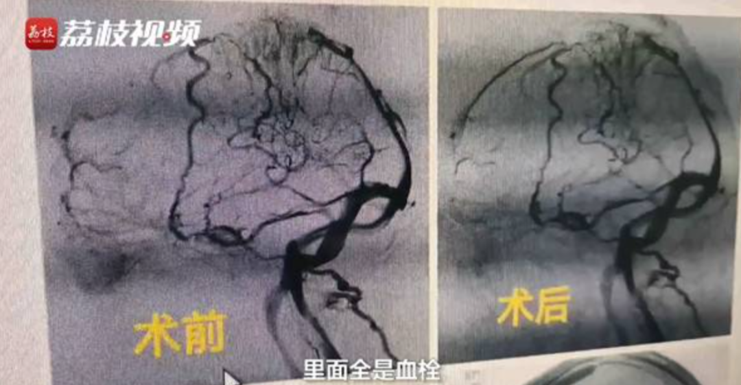 开元体育劈硬柴pik5 ngang2 ssa4(图3)